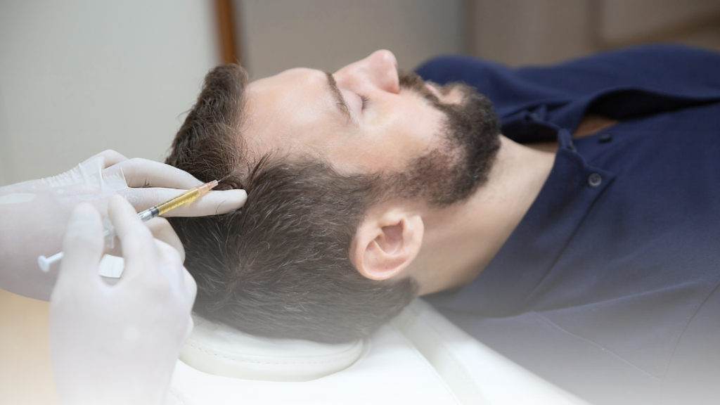 Cegah Kebotakan Sejak Dini dengan PRP Hair Treatment