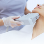 Ciptakan Wajah V-Shape Tanpa Ribet dengan Treatment HIFU