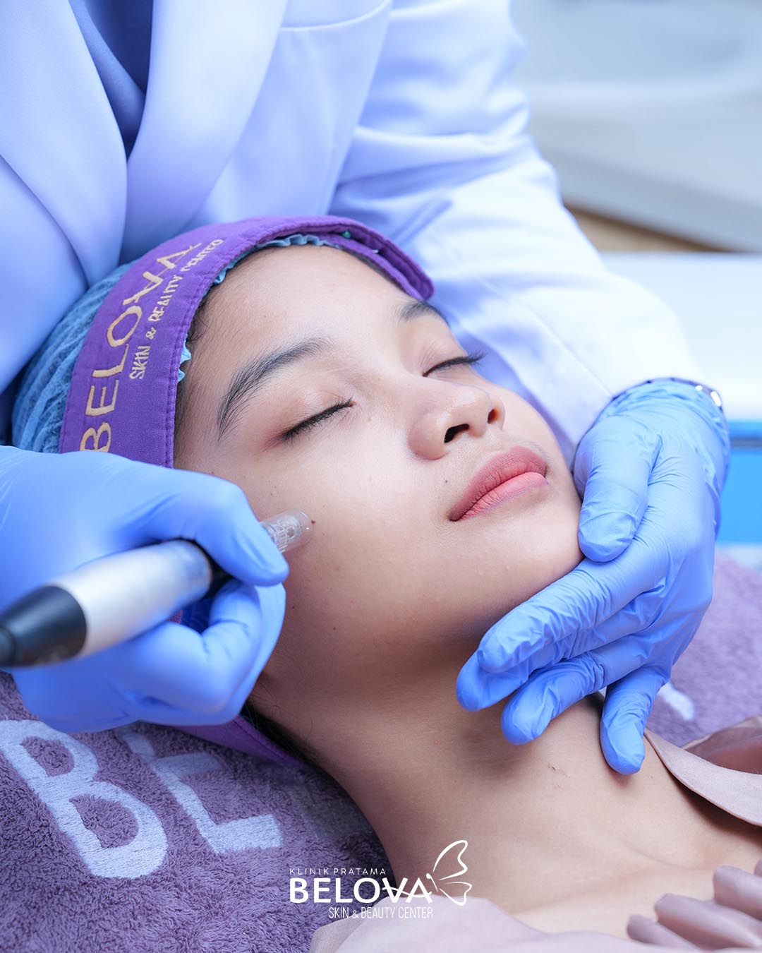 Scar Treatment Basic